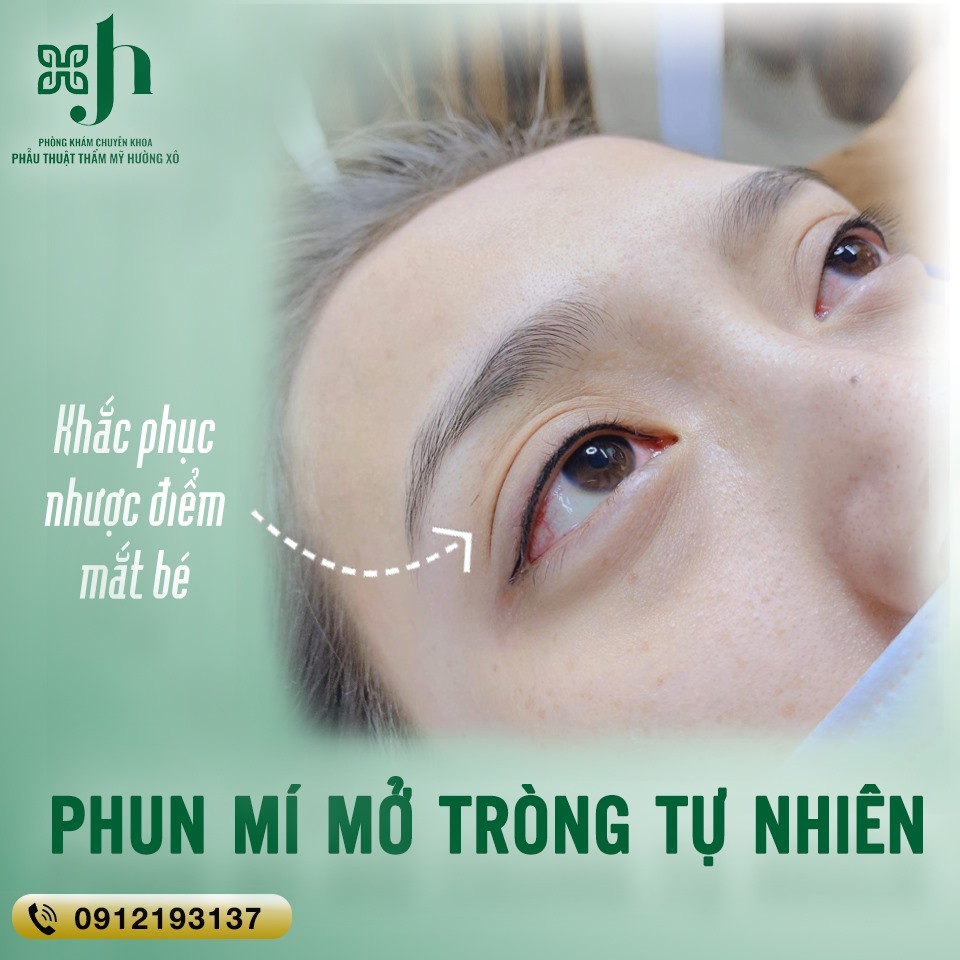 Phun mí mở tròng tại Vinh, Nghệ An