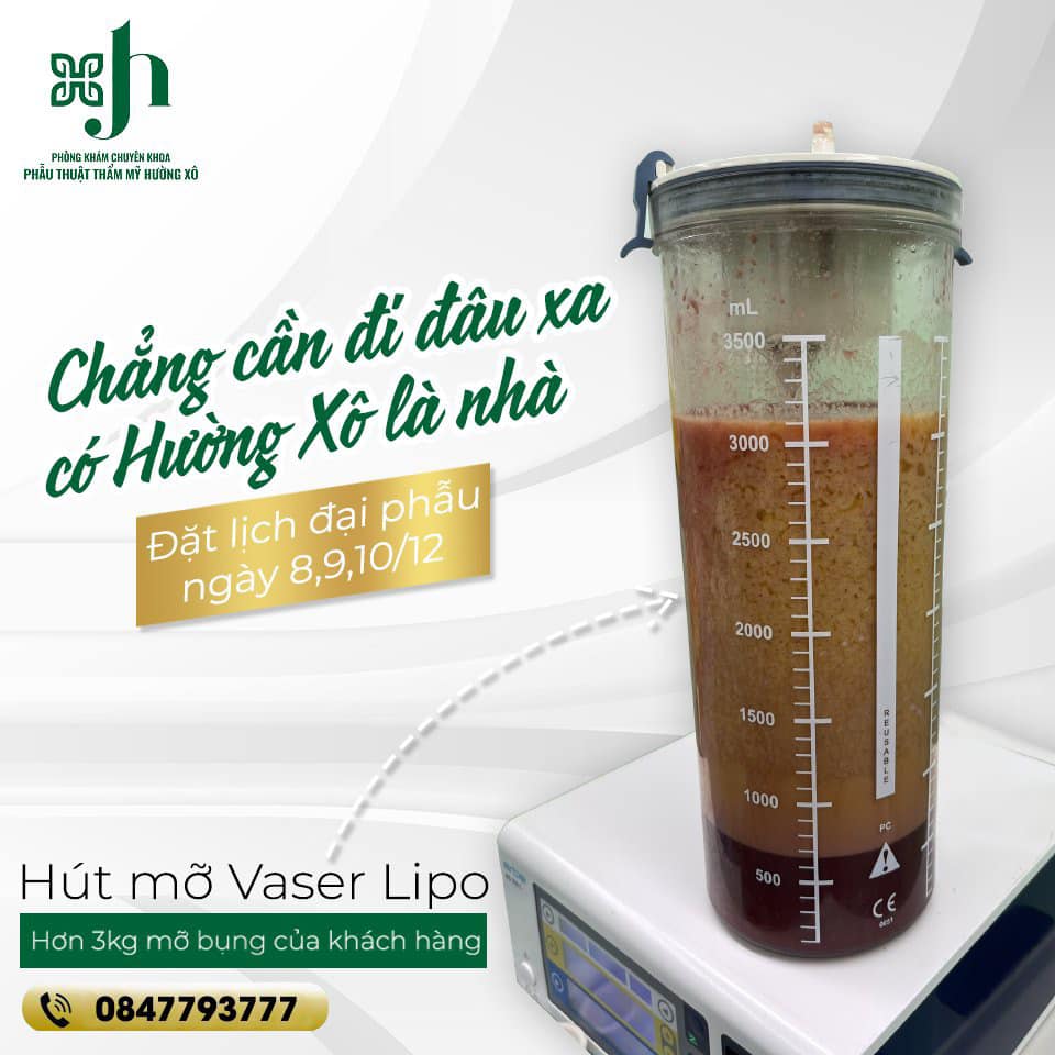 Hút mỡ Vaser Lipo tại Vinh