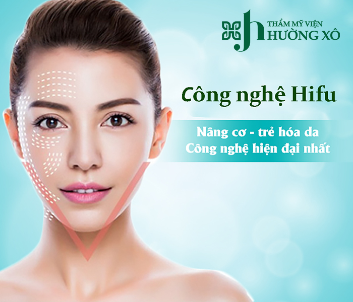 Nâng cơ Hifu 