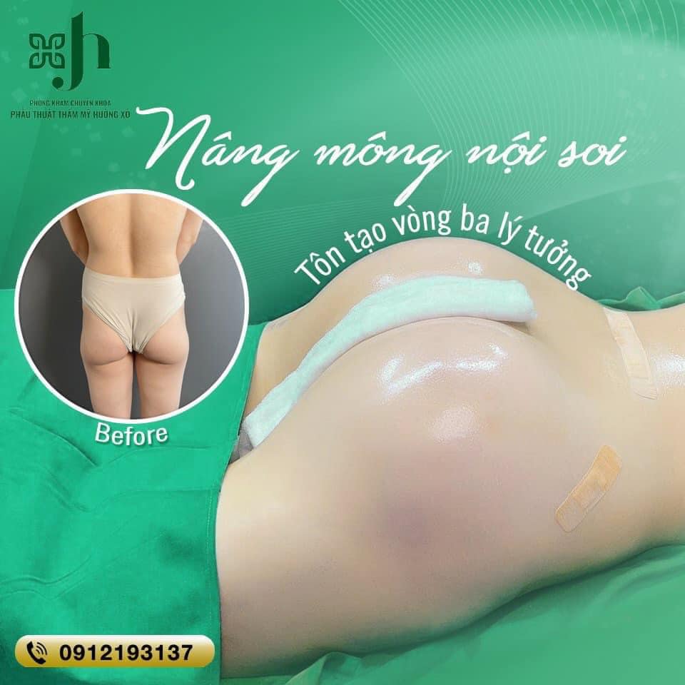 Dịch vụ độn mông