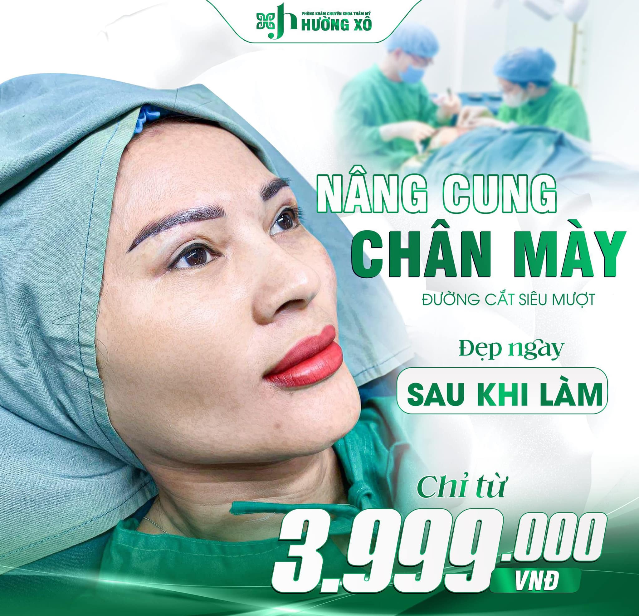 Nâng cung chân mày