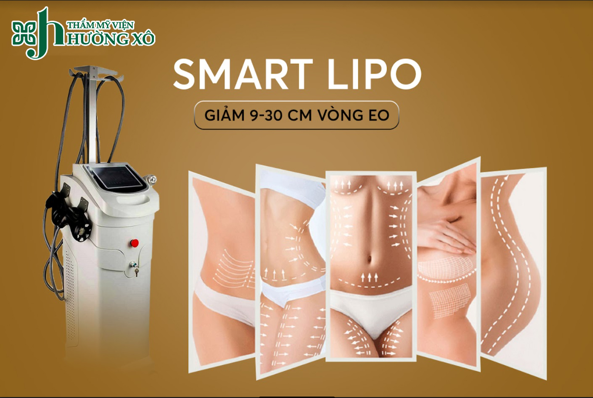 Giảm béo smart lipo
