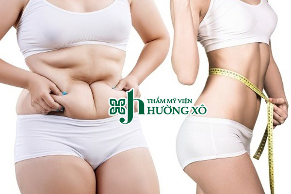 Giảm béo smart lipo