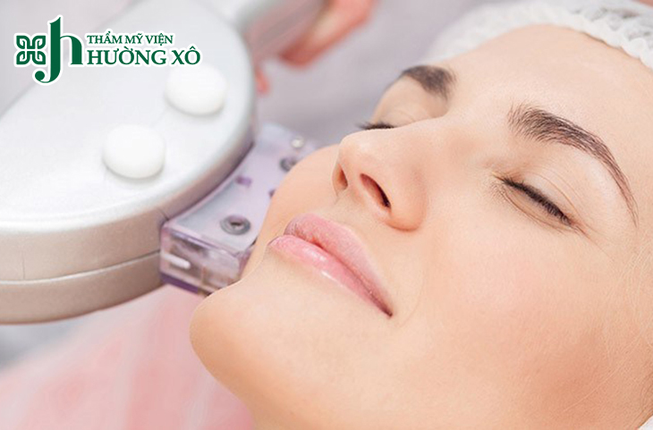 Triệt lông mép