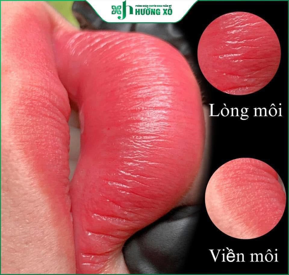 Phun xăm môi