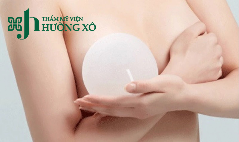 Nâng ngực