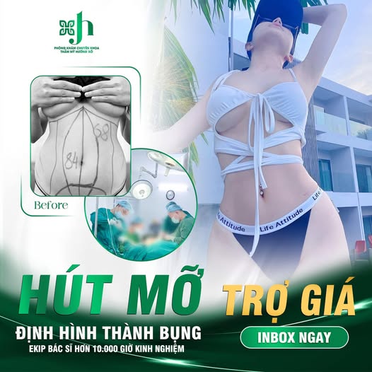 Hút mỡ bụng
