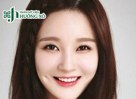 Tạo má lúm đồng tiền