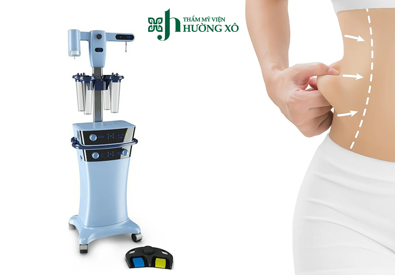 Hút mỡ Vaser Lipo