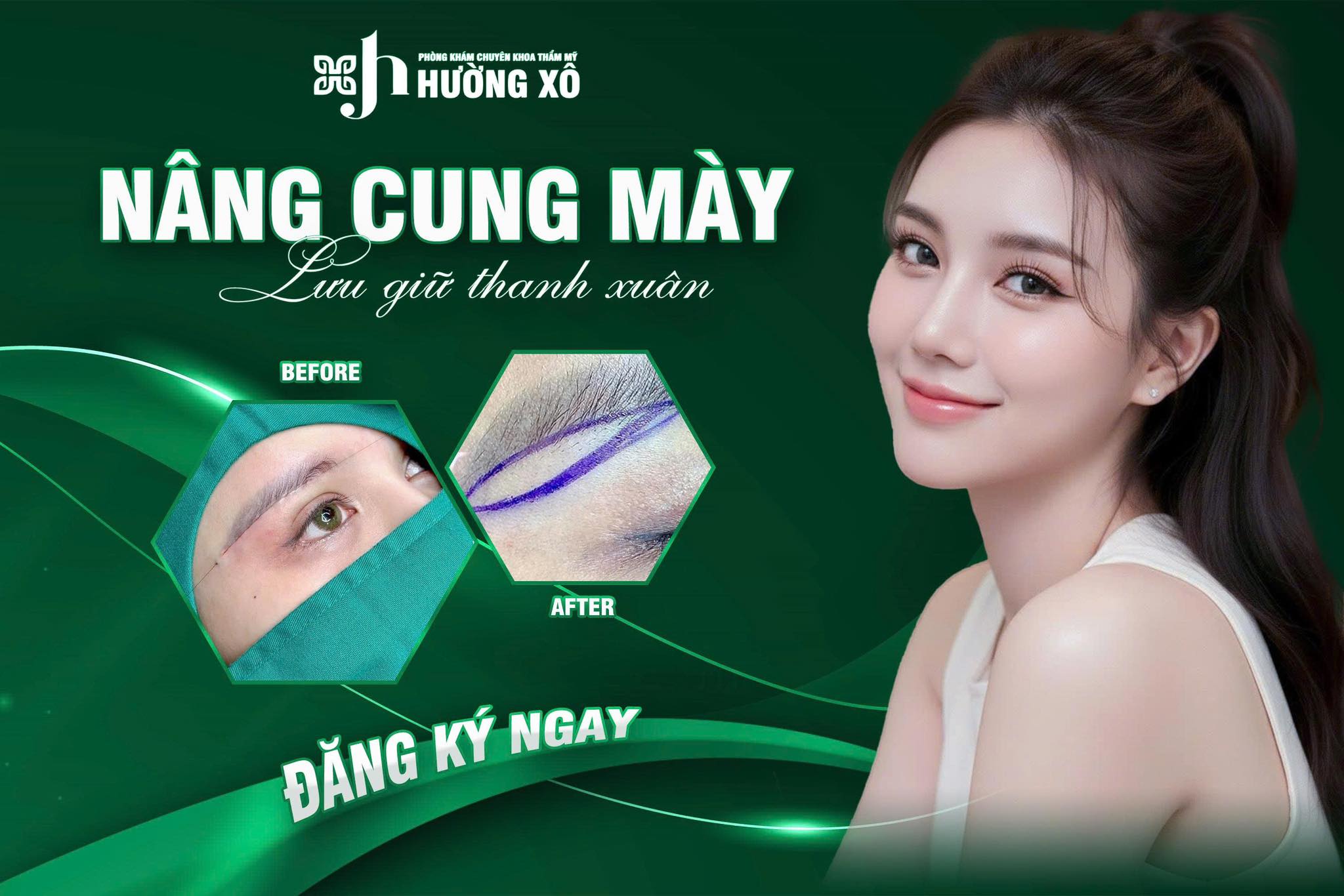 Nâng cung mày